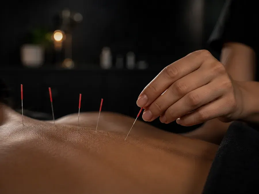 Acupuncture